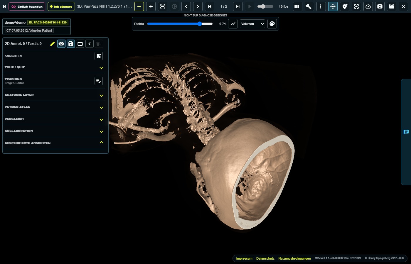 Echte 3D-Volumendarstellung der isolierten Demoakte demo^demo im PawPacs Viewer